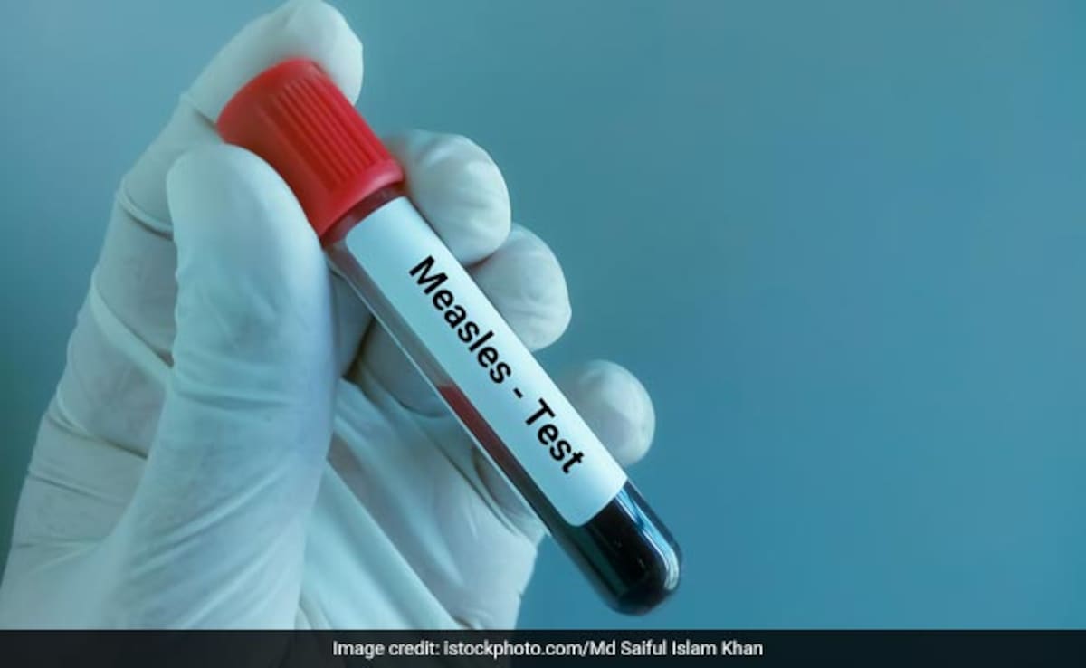 Europe Reports Highest Number Of Measles Cases Since 1997