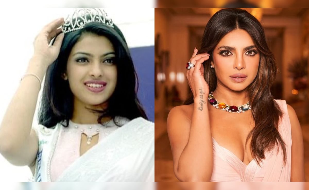 How Priyanka Chopra's Father Reacted To The Actress's Botched Nose Surgery