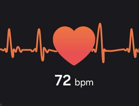 ecg e