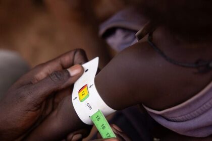 Worsening hunger could push millions closer to famine in 13 global hotspots